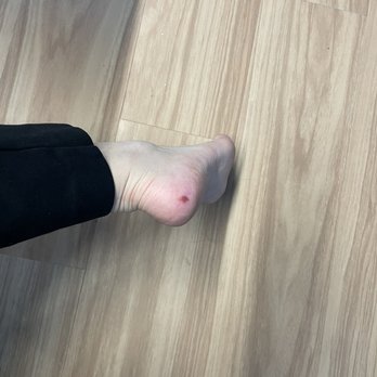 Grandlux Nails Lounge Dunvale - Wounds I had after visiting Grandlux Nail - Nail Salons Near Me - Houston, Texas Grandlux Nails Lounge Dunvale - Wounds I had after visiting Grandlux Nail - Nail Salons Near Me - Houston, Texas