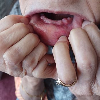 Affordable Dentures & Implants - General Dentistry Near Me - Las Vegas, Nevada