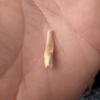 Friendly Chinese Buffet - Bone I found in my chicken fried rice. - Chinese Near Me - Buffalo, New York Friendly Chinese Buffet - Bone I found in my chicken fried rice. - Chinese Near Me - Buffalo, New York