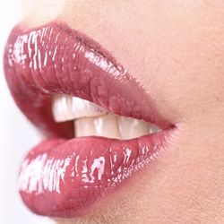 Veneers in 1 visit