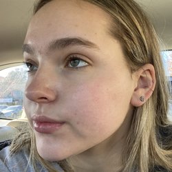 California Dermatology Care - After