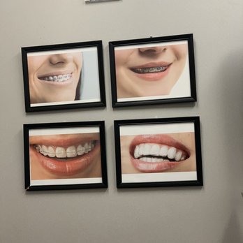 Michael Orthodontics - Orthodontists Near Me - Silver Spring, Maryland Michael Orthodontics - Orthodontists Near Me - Silver Spring, Maryland
