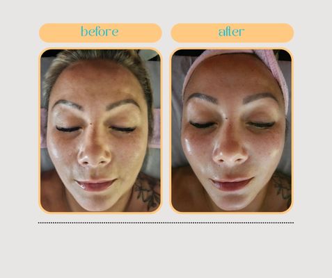 Dermodality Pumpkin Facial! - Transform Your Skin with the Power of Pumpkin! 

Check out these incredible before and after results from our Dermodality Pumpkin Facial! 

 Before:▫️ Uneven texture ▫️ Clogged pores, redness and inflammation

After: ▫️ Reduced redness, reduced inflammation
▫️ Smoother texture

Experience the rejuvenating benefits of pumpkin enzymes that exfoliate, hydrate, and nourish your skin, revealing a radiant glow. Perfect for all skin types!

Book your appointment today and get ready to fall in love with your skin again. DM us or visit bebareesthetics.glossgenius.com to schedule your session!