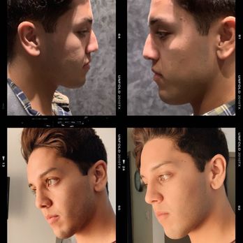 Westside Head & Neck - Comparison! - Allergists Near Me - Santa Monica, California Westside Head & Neck - Comparison! - Allergists Near Me - Santa Monica, California