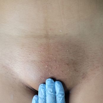 The Kitty Wax Nyc - Brazilian Wax #educationalpost - Waxing Near Me The Kitty Wax Nyc - Brazilian Wax #educationalpost - Waxing Near Me