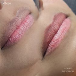 Dark Lip neutralization