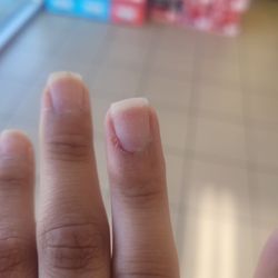 H2O Hair & Nails Salon - Torn off skin