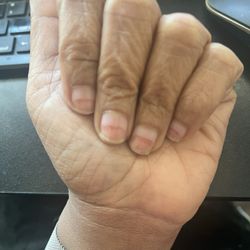 Envogue Nails - Nail damage.
