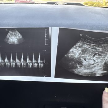 Unique Ultrasound Surprise - Ultrasound pics - Ultrasound Imaging Centers Near Me - Surprise, Arizona Unique Ultrasound Surprise - Ultrasound pics - Ultrasound Imaging Centers Near Me - Surprise, Arizona