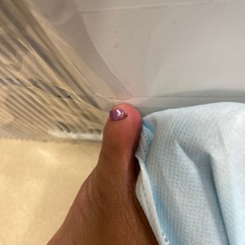 Paradise Tomball Nails & Spa - Infected and swollen pinky toe after 4 days of getting my pedicure done here! - Nail Salons Near Me - Tomball, Texas