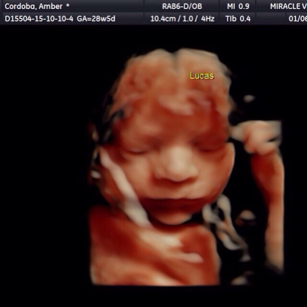 Our little guy at almost 29 weeks Our little guy at almost 29 weeks