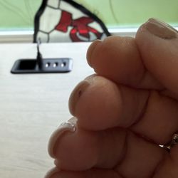 BellaVi Day Spa - This is where the nail tech cut the top of my Finger
