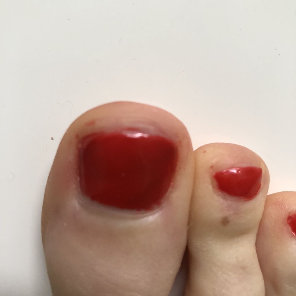 Polish Perfect - Really bad gel application - Nail Salons Near Me - Eagle, Idaho Polish Perfect - Really bad gel application - Nail Salons Near Me - Eagle, Idaho