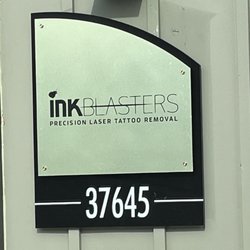 Ink Blasters Precision Laser Tattoo Removal