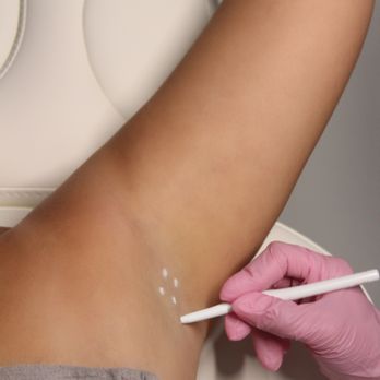 The Body Bar - Underarm sweating tox $375 - Medical Spas Near Me - Corona, California The Body Bar - Underarm sweating tox $375 - Medical Spas Near Me - Corona, California