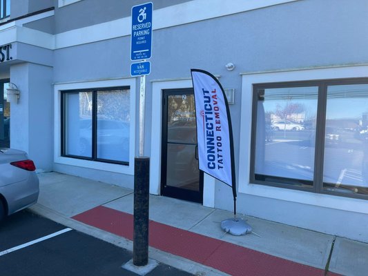 Connecticut Tattoo Removal