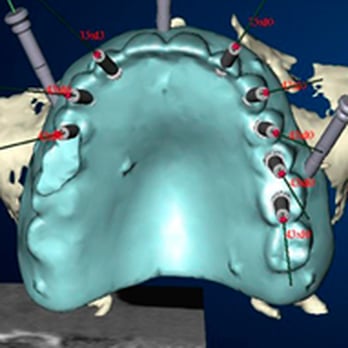CenDenta - Oral Surgeons Near Me - Berlin, BE CenDenta - Oral Surgeons Near Me - Berlin, BE