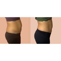 Body BY Draya - Before and after