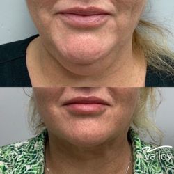 Valley Surgical, Aesthetics & Vein Care