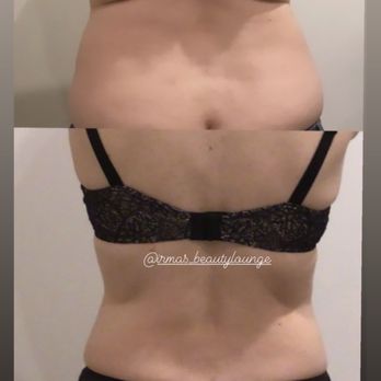 Irmas Beauty Lounge - Fat burning - Body Contouring Near Me