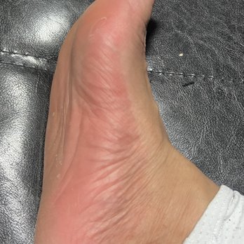 Flower City Nails & Spa - My foot is so raw and tender to the touch he scrubbed them so hard. - Day Spas Near Me - Rochester, New York Flower City Nails & Spa - My foot is so raw and tender to the touch he scrubbed them so hard. - Day Spas Near Me - Rochester, New York