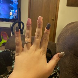 As you see my pointer finger my middle finger and my ring finger are all crucid. The pointer is the worst. As you see my pointer finger my middle finger and my ring finger are all crucid. The pointer is the worst.