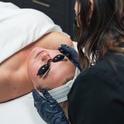 Kalon Skin Studio - Extractions