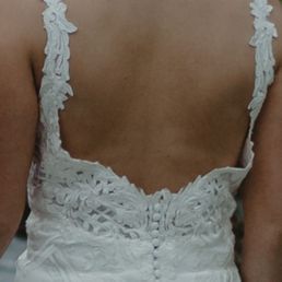 This was a concern I had during the second fitting and it appears it was never addressed.
