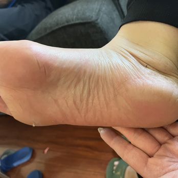Wonderful Nails - I pay for the extra callus remover as  you can see there's some dead skin still there and my back of my heel was never touch - Nail Salons Near Me - West Covina, California