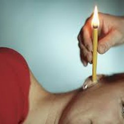 Wendy's Skin Care - Ear candling