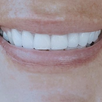 Paragon Dental - Close up!! - Cosmetic Dentists Near Me - Modesto, California Paragon Dental - Close up!! - Cosmetic Dentists Near Me - Modesto, California