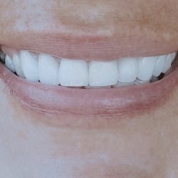Paragon Dental - Close up!!
