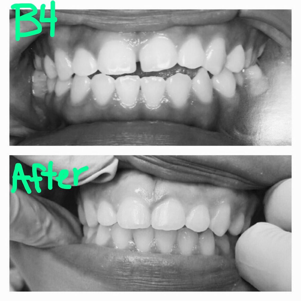 SHEPHERD DENTAL Updated October 2024 915 N Shepherd Dr, Houston, Texas General Dentistry