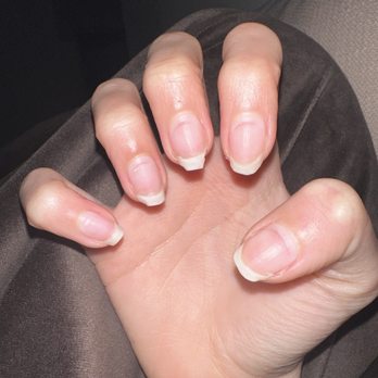 Venice Nail Spa - Left my nails brittle. Almost every nail has deep file marks after getting them professionally removed. - Nail Salons Near Me - Dublin, California