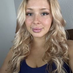 Allure Medical - After lip filler had settled