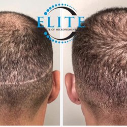 Scalp Masters Atlanta