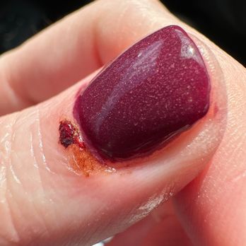 AZ Pro Nails - Chuck of skin the nail tech took off while rushing to cut my cuticles. - Nail Salons Near Me - Scottsdale, Arizona