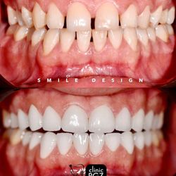BGZ Dental Turkey