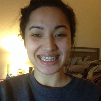 Phan Orthodontics - When I first started - Orthodontists Near Me - San Jose, California