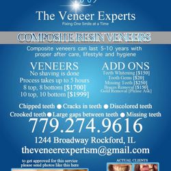 The Veneer Experts - Prices and services