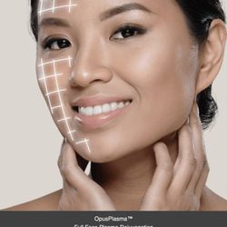 Opus Plasma Laser Treatment