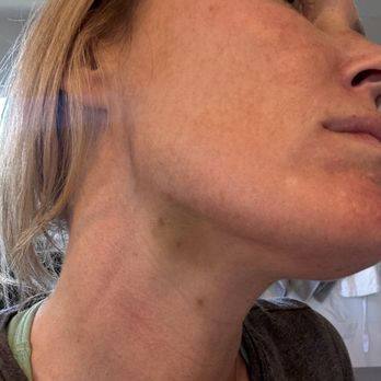 Facial Aesthetics - Skin Care Near Me - Denver, Colorado