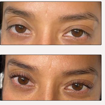 Eternal Esthetics - Skin Care Near Me - Orlando, Florida