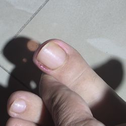 D - Luxe Nails Studio - Toe damage