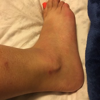 Passion Nails - The scab on my ankle is from the lady missing my foot with the foot stone. It hurts really badly. - Nail Salons Near Me - Palm Desert, California