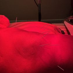 Acupuncture Institute of Michigan - Acupuncture