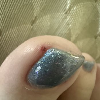 She Nail & Lashes - Toe was bleeding - Nail Salons Near Me - Mesa, Arizona She Nail & Lashes - Toe was bleeding - Nail Salons Near Me - Mesa, Arizona