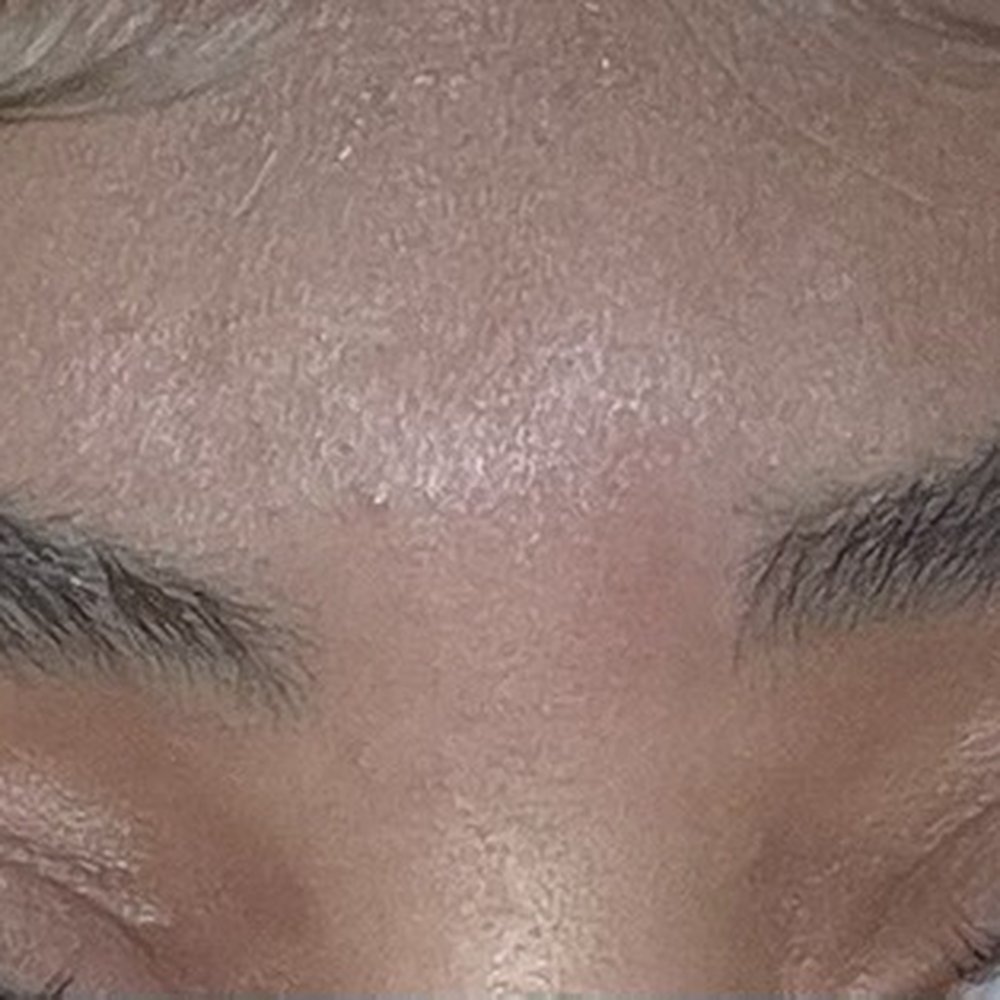 over waxed brow