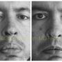 Photo of Lam Institute for Hair Restoration