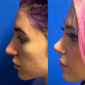 Ronald J Edelson, MD - Cosmetic Surgeons Near Me - San Diego, California Ronald J Edelson, MD - Cosmetic Surgeons Near Me - San Diego, California